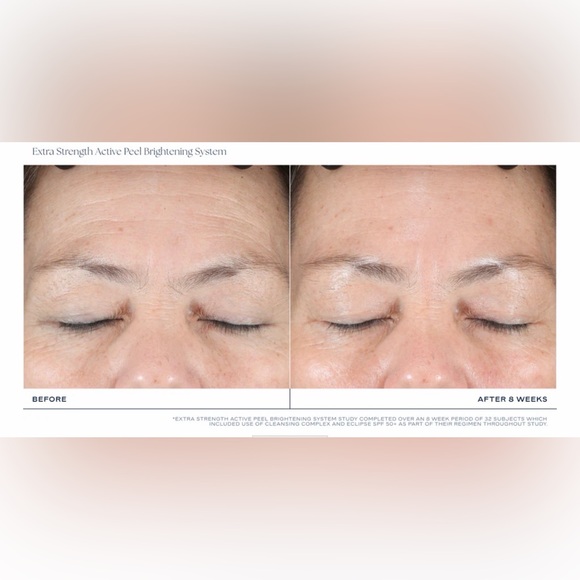 iS CLINICAL Extra Strength Active Peel Brightening System - Picture 4 of 14